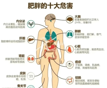 肥胖症的病因有哪些
