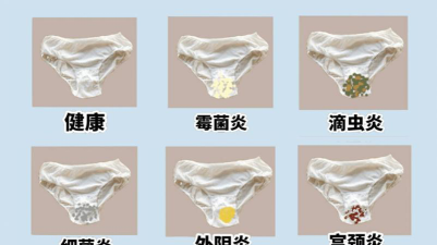 外阴为什么会搔痒